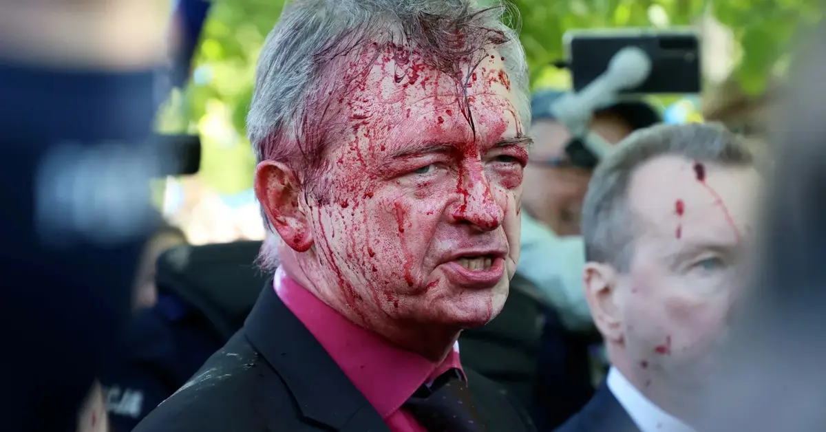 Główne zdjęcie - Ambasador Rosji oblany czerwoną farbą w Warszawie. Do ataku przyznała się ukraińska dziennikarka