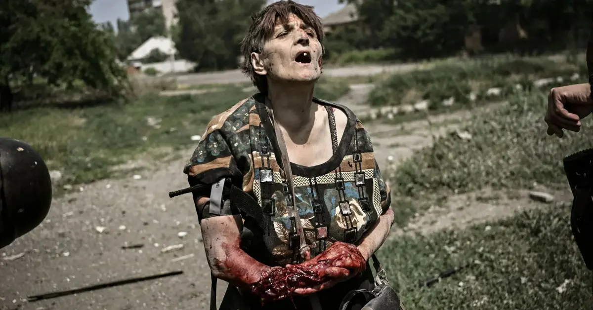 Ranna kobieta w Donbasie